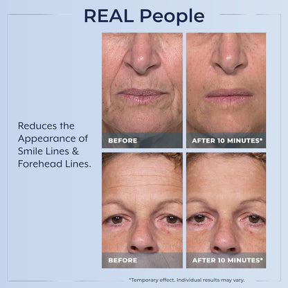Rapid Reduction Serum - Visibly Reduces Under-Eye Bags & Wrinkles