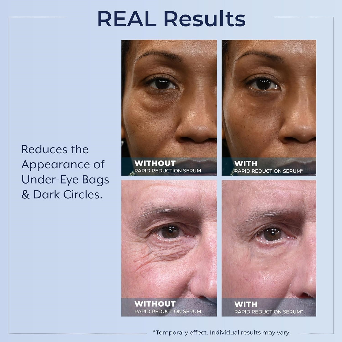 Rapid Reduction Serum - Visibly Reduces Under-Eye Bags & Wrinkles